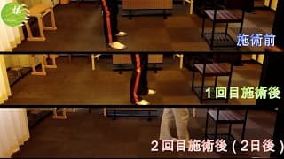 【肉離れ】野球の試合中の肉離れのビフォーアフター