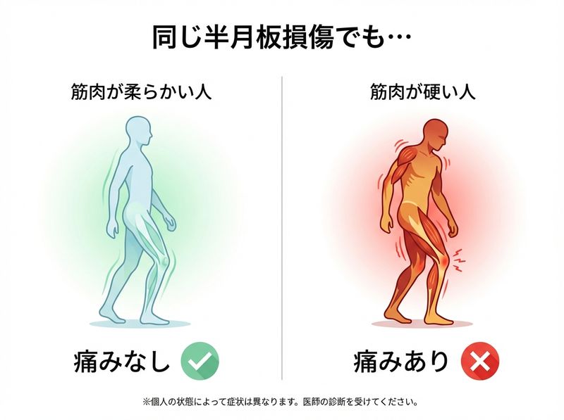 痛みが出にくい人と出やすい人の比較:筋肉の柔軟性・防御反応・動作の癖の違い