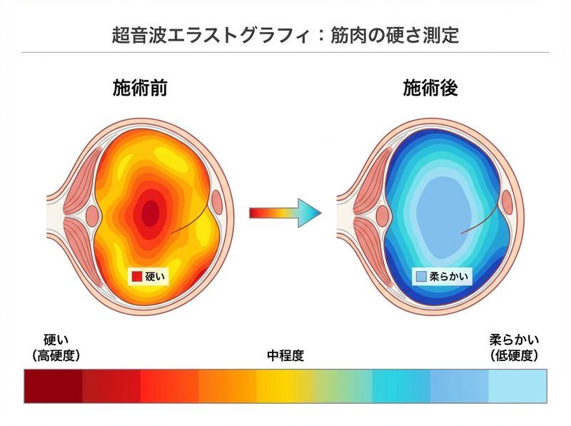 超音波エラストグラフィによる施術前後の筋肉の硬さの変化