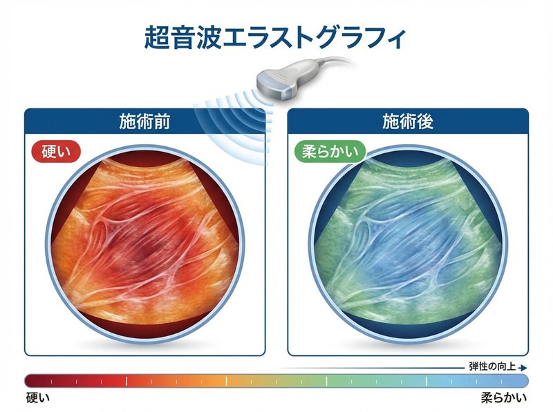 超音波エラストグラフィによる筋スティフネス計測の様子