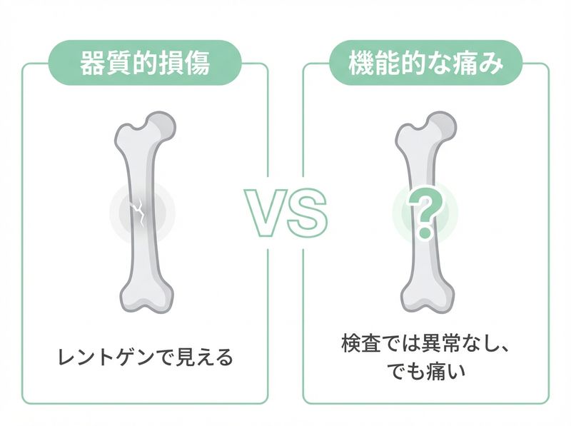 器質的な損傷と機能的な痛みの違い:構造の問題と筋肉の問題